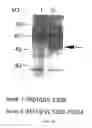 Fig. 14 - Methods for synthesizing sugar chains using β1,3-N-acetylglucosaminyltransferase