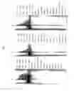 Fig. 15 - Methods for synthesizing sugar chains using β1,3-N-acetylglucosaminyltransferase