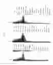 Fig. 17 - Methods for synthesizing sugar chains using β1,3-N-acetylglucosaminyltransferase