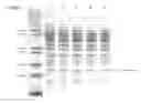 Fig. 08 - Xylose utilization in recombinant zymomonas