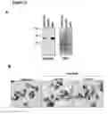 Fig. 11 - Human androgen receptor alternative splice variants
