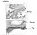 Fig. 12 - Human androgen receptor alternative splice variants