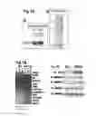 Fig. 22 - Human androgen receptor alternative splice variants