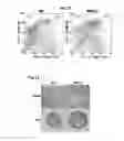 Fig. 23 - Human androgen receptor alternative splice variants