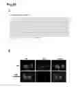 Fig. 29 - Human androgen receptor alternative splice variants