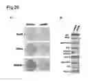 Fig. 31 - Human androgen receptor alternative splice variants