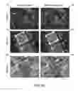 Fig. 11 - CELL CARRIER, ASSOCIATED METHODS FOR MAKING CELL CARRIER AND CULTURING CELLS USING THE SAME