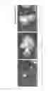 Fig. 07 - Method for efficient production of induced pluripotent stem cells utilizing cells derived from oral mucosa