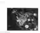 Fig. 08 - Method for efficient production of induced pluripotent stem cells utilizing cells derived from oral mucosa