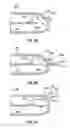 Fig. 07 - Portable electronic device having a concealed jack socket