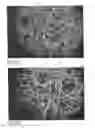 Fig. 04 - METHOD AND TOOL FOR MAINTENANCE OF HARD SURFACES, AND A METHOD FOR MANUFACTURING SUCH A TOOL