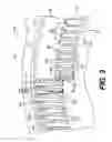 Fig. 04 - Transmission housing