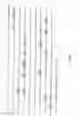 Fig. 02 - Method for HLA typing