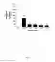 Fig. 06 - Methods for treating Kaposi sarcoma