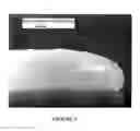 Fig. 07 - Xylitol containing comestible product