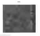 Fig. 06 - COMPOUNDS FOR THE SELECTIVE TREATMENT OF THE INTESTINAL IMMUNO-INFLAMMATORY COMPONENT OF THE CELIAC DISEASE