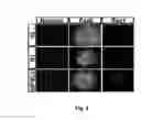Fig. 03 - Exogenous Pax6 nucleic acid expression in primate neural stem cells maintains proliferation without differentiation