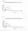 Fig. 06 - Sublingual Spray Formulation Comprising Dihydroartemesinin