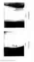 Fig. 06 - Treating eczema and/or psoriasis