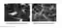 Fig. 01 - Prophylactic and/or therapeutic agent for dysmenorrhea