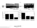 Fig. 04 - METHODS OF PREVENTING, TREATING AND DIAGNOSING DISORDERS OF PROTEIN AGGREGATION