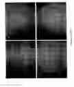 Fig. 17 - METHODS OF PREVENTING, TREATING AND DIAGNOSING DISORDERS OF PROTEIN AGGREGATION