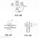 Fig. 07 - Peripheral Brachytherapy of Protruding Conformable Organs