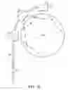 Fig. 12 - Peripheral Brachytherapy of Protruding Conformable Organs