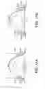 Fig. 13 - Peripheral Brachytherapy of Protruding Conformable Organs