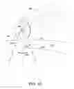 Fig. 14 - Peripheral Brachytherapy of Protruding Conformable Organs