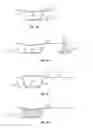 Fig. 03 - Targeted delivery of magnetically tagged active agents in combination with negative pressure wound therapy