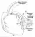 Fig. 01 - INTRACORONARY DEVICE AND METHOD OF USE THEREOF