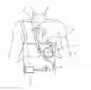 Fig. 01 - Ventricular assist device