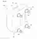 Fig. 08 - Ventricular assist device