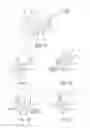 Fig. 06 - Artificial sphincter system and method