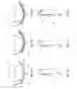 Fig. 13 - Tissue restraining devices and methods of use
