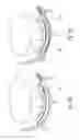 Fig. 17 - Tissue restraining devices and methods of use