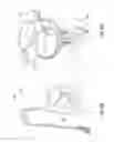 Fig. 20 - Tissue restraining devices and methods of use