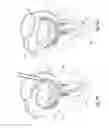 Fig. 22 - Tissue restraining devices and methods of use