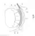 Fig. 28 - Tissue restraining devices and methods of use