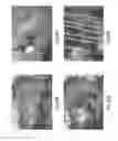Fig. 43 - Tissue restraining devices and methods of use