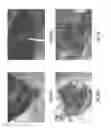 Fig. 44 - Tissue restraining devices and methods of use