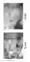 Fig. 45 - Tissue restraining devices and methods of use