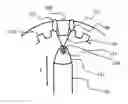 Fig. 01 - METHOD AND APPARATUS FOR REDUCING TISSUE TRAUMA DURING IPP PROCEDURE