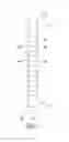 Fig. 04 - Adjustable length rear tip extender for penile prosthesis