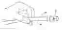 Fig. 01 - DEVICE FOR ENDOSCOPIC TREATMENT OF UPPER GASTROINTESTINAL BLEEDING