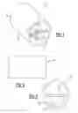 Fig. 02 - DEVICE FOR ENDOSCOPIC TREATMENT OF UPPER GASTROINTESTINAL BLEEDING