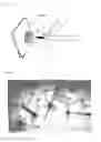Fig. 05 - Disposable shield for a medical tool