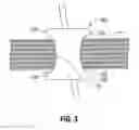 Fig. 03 - Access assembly with translating lumens