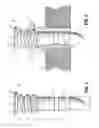 Fig. 04 - SELF DEPLOYING BODILY OPENING PROTECTOR